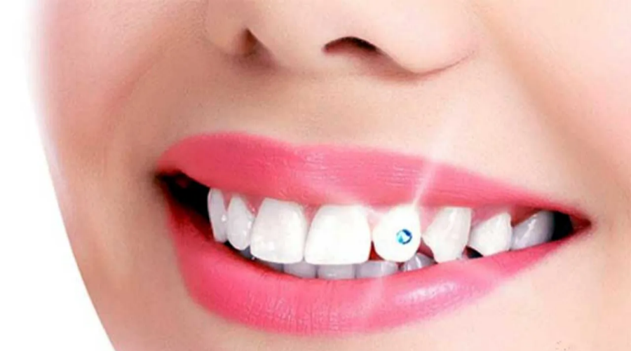 Tooth Jewellery Dentist Clinic in South Mumbai